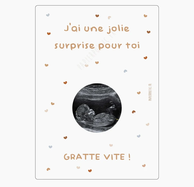 Carte à gratter échographie | Coeurs