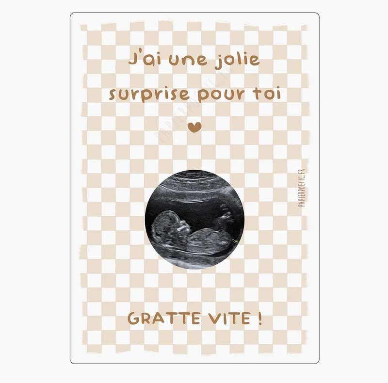 Carte à gratter échographie | Damier