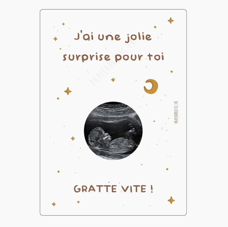 Carte à gratter échographie | Ciel étoilé